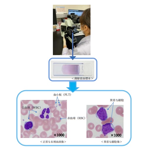 血液像目視