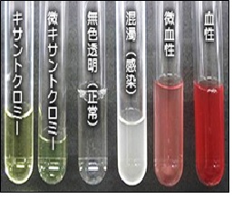 髄液の色調(一般技術教本より) 髄液の色調(一般技術教本より)