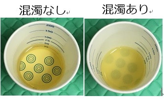 尿の混濁の有無 尿の混濁の有無