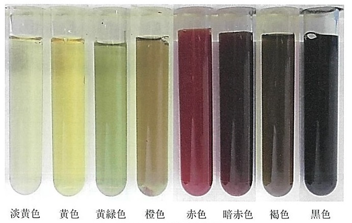 体腔液の色調(一般技術教本より) 体腔液の色調(一般技術教本より)