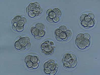 （8細胞期胚の写真）