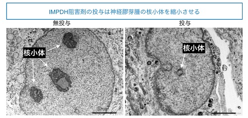 IMPDH阻害剤の投与は神経膠芽腫の核小体を縮小させる