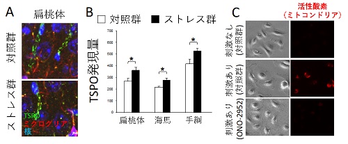 慢性ストレスによるミクログリアのTSPO活性化