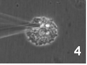 図2-4　細胞質から薬物や代謝物などの成分を吸い上げる様子