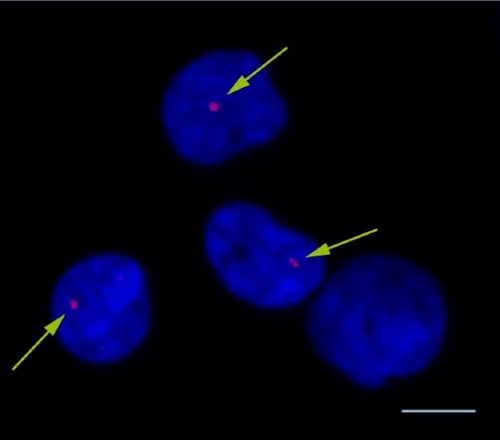 図1：放射線被ばくにより誘導されたγ-H2AXフォーカス