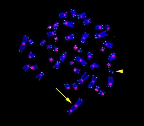 図2：放射線被ばくによりリンパ球に誘導された染色体異常