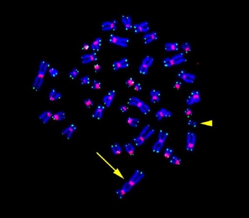 図2:放射線被ばくによりリンパ球に誘導された染色体異常