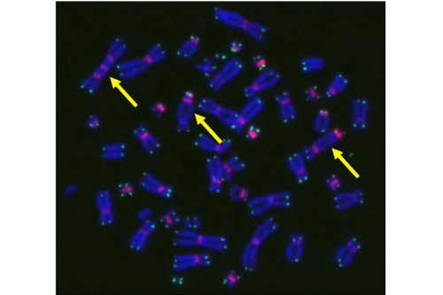 【研究成果】放射線治療による副作用を染色体異常数の血液検査から予測～個人の放射線感受性に基づいた個別化治療の可能性～(動画あり)