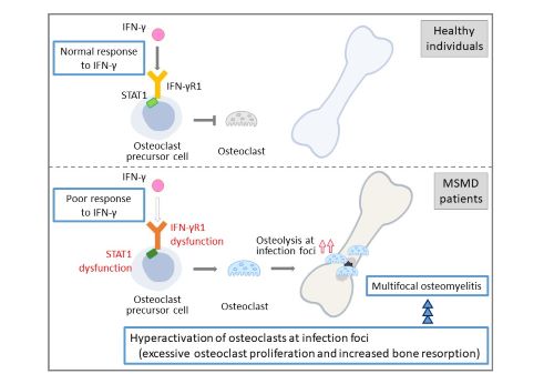 The suggested disease model of multifocal osteomyelitis in MSMD patients