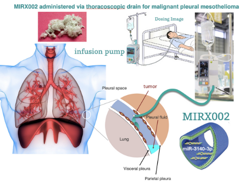 Trial asbestos cancer drug MIRX002