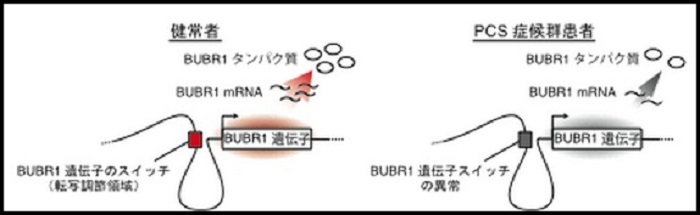 健常者とPCS症候群患者の遺伝子スイッチを比較した図