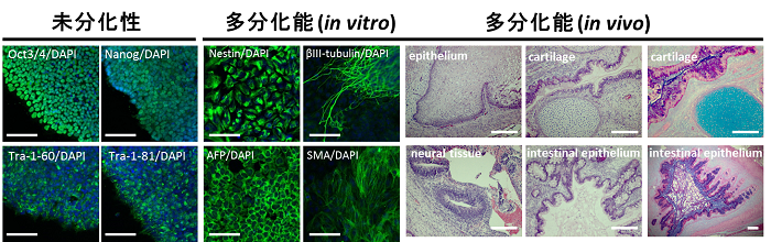 図3　無血清培養条件下にて誘導・維持したヒトiPS細胞の未分化性と多分化能のin vitroおよびin vivoでの解析