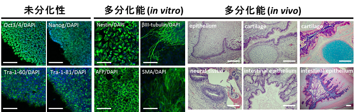 図3 無血清培養条件下にて誘導・維持したヒトiPS細胞の未分化性と多分化能のin vitroおよびin vivoでの解析