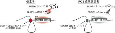 図4 健常者とPCS症候群患者の図