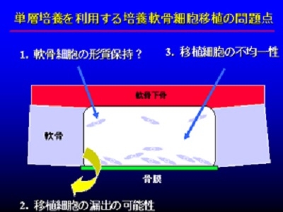 移植部分の断面図(単層培養)