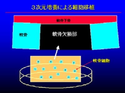 移植部分の断面図（３次元培養）