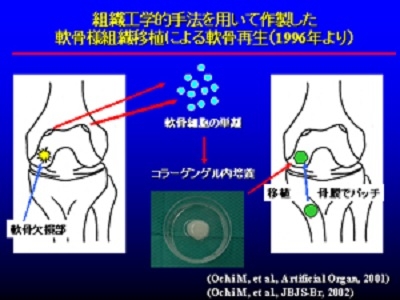 組織工学的手法を用いて作製した軟骨様細胞移植による軟骨再生