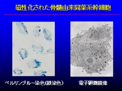 マグネティックビーズを取り込んだ細胞