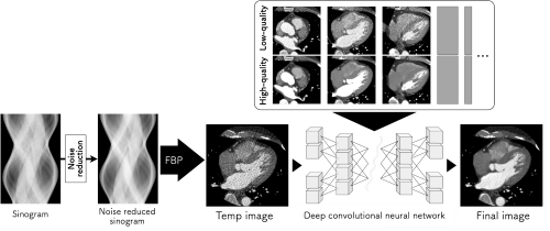 Improving Medical CT Image Quality Using Deep Learning | Hiroshima ...