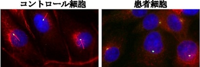 図2.繊毛を赤色、中心体を緑色、核を青色で染色