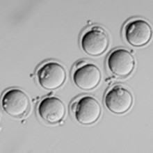 卵子 写真