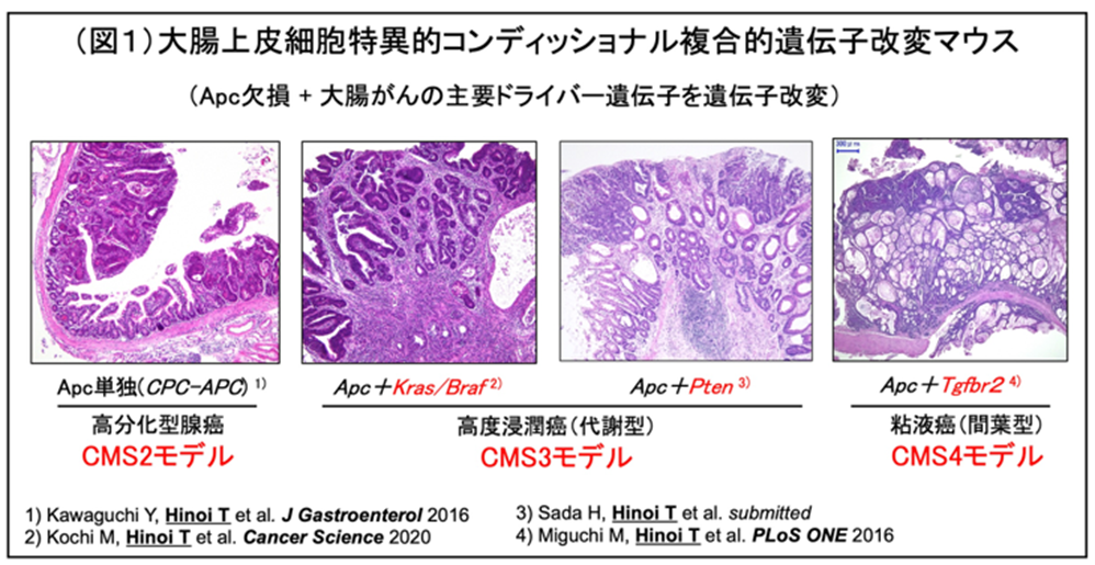 研究成果】世界初！難治性大腸がんを再現できるマウスを開発 〜大腸が