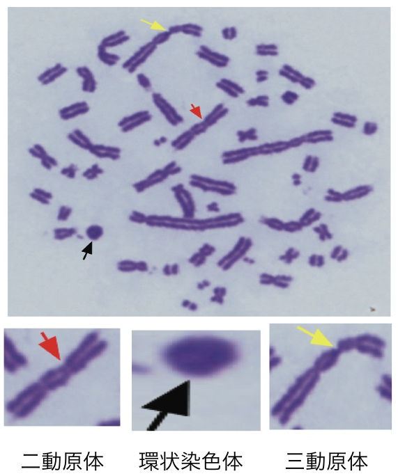 図2 ギムザ法とPNA-FISH法を用いた異常染色体の検出 ギムザ染色