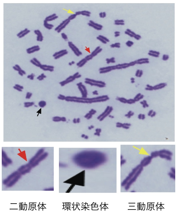 図２　ギムザ法とPNA-FISH法を用いた異常染色体の検出 ギムザ染色