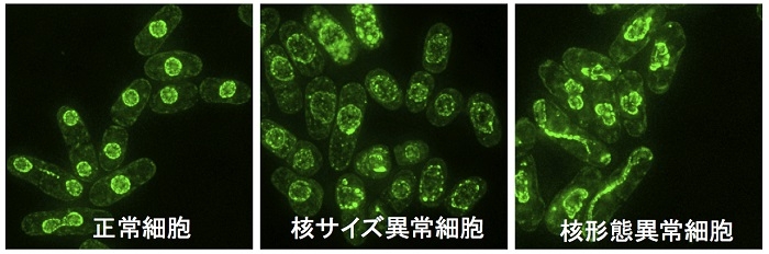 図2. 分裂酵母の正常細胞と核サイズ、核形態異常細胞