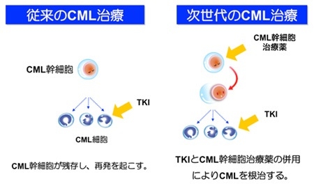 次世代のＣＭＬ治療