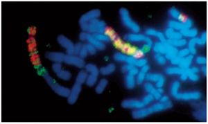 Gene amplification in human tumor cells