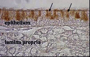 Antimicrobial peptide (βdefensin) in hen oviduct
