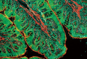 An immunofluorescence image of a tight junction protein in the rat colon