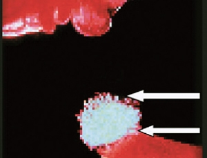 Ovulating follicle