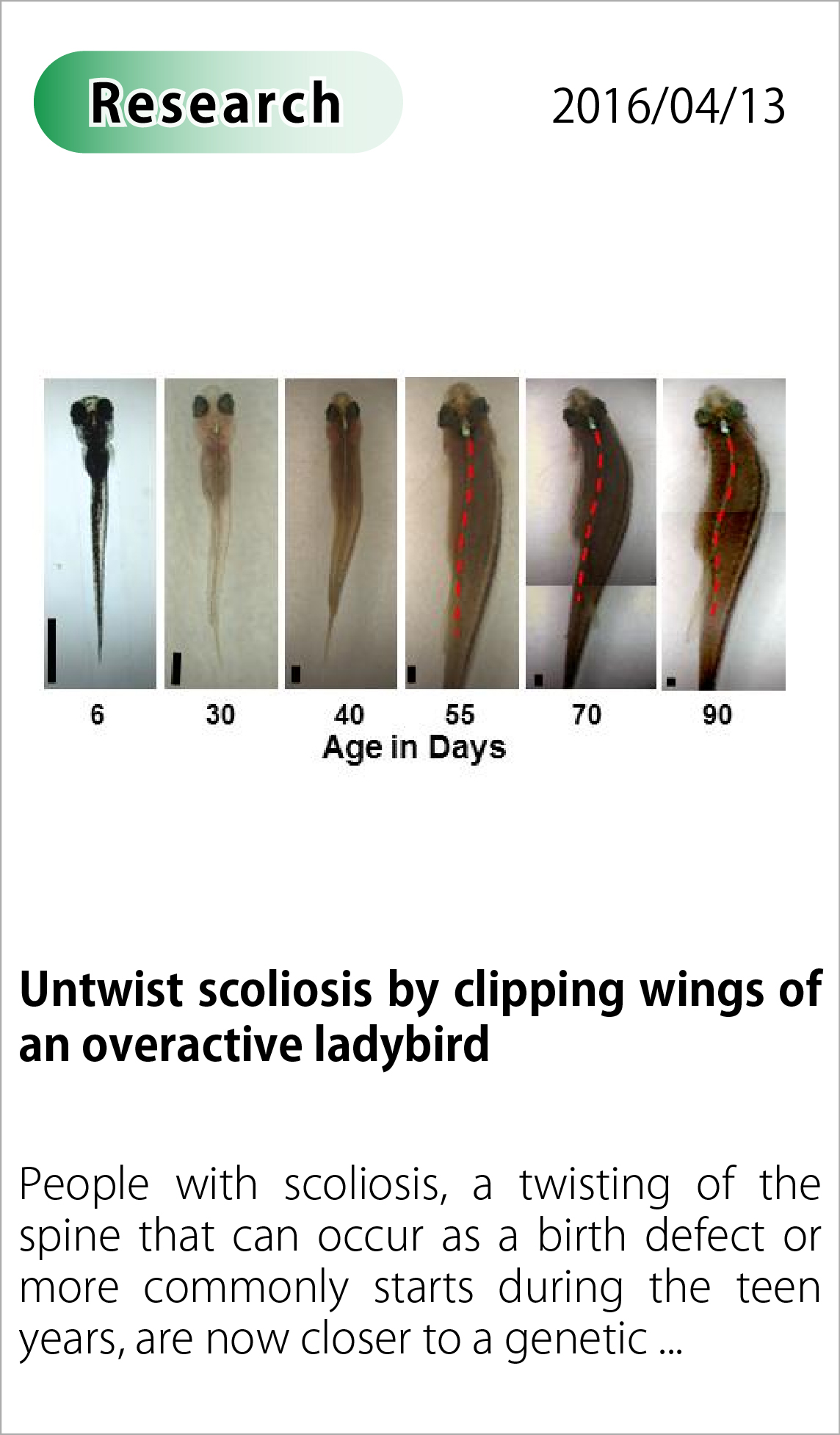 Untwist scoliosis by clipping wings of an overactive ladybird