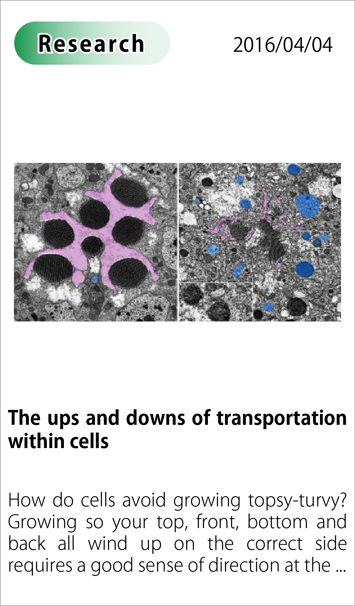 The ups and downs of transportation within cells