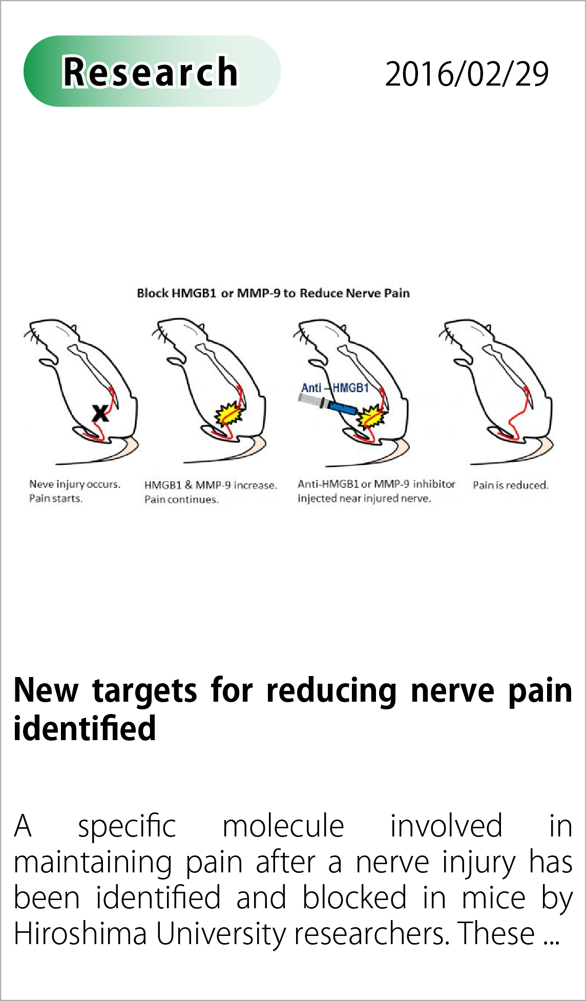New targets for reducing nerve pain identified