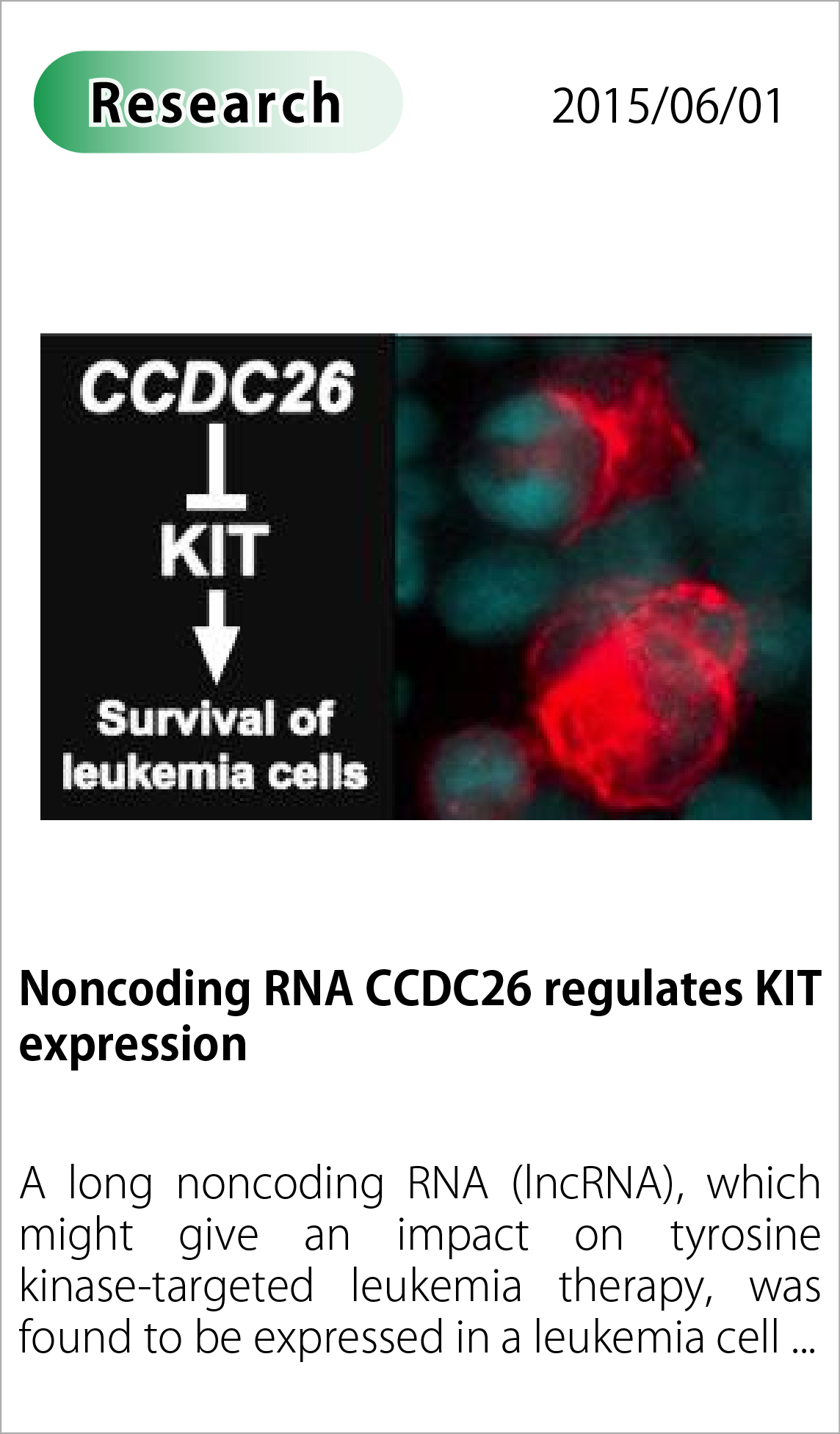 Noncoding RNA CCDC26 regulates KIT expression