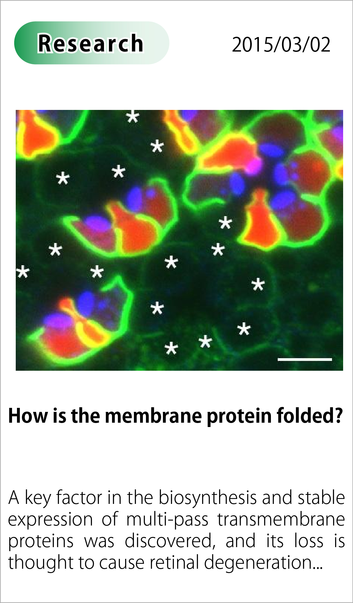 How is the membrane protein folded?