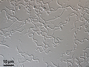 図1 新綱微生物 Oligoflexus tunisiensis の光学顕微鏡写真