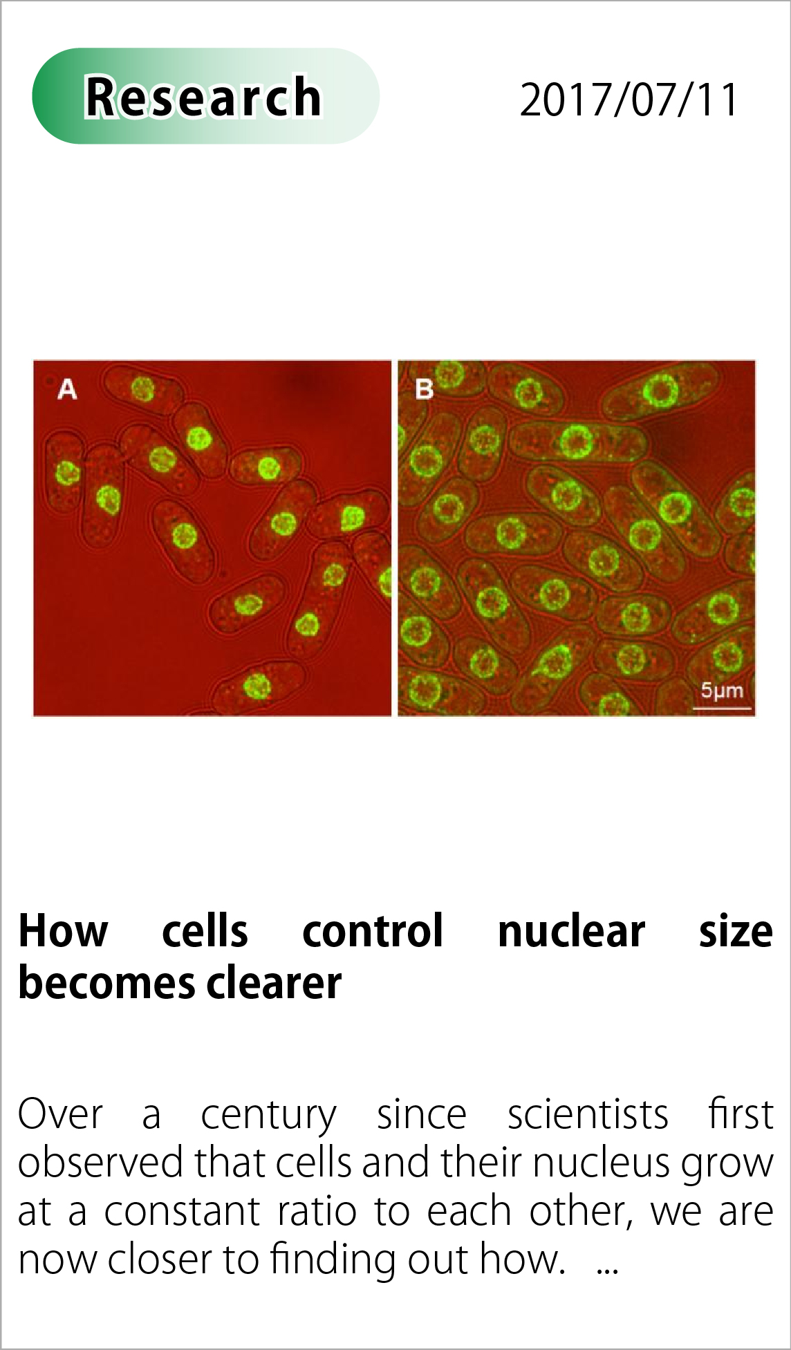 How cells control nuclear size becomes clearer