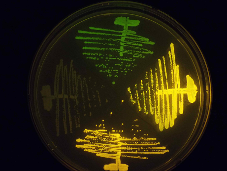 添付図；蛍光蛋白質発現で緑・オレンジ色に光る酵母のコロニー
