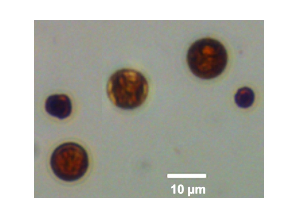 zooxanthellae